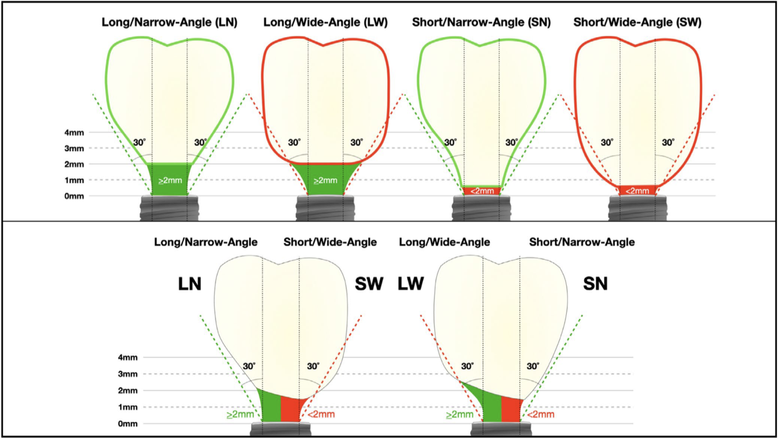 Diagram of the four study groups: transmucosal abutment height above or below 2 mm crossed with restorative emergence angle above or below 30 degrees