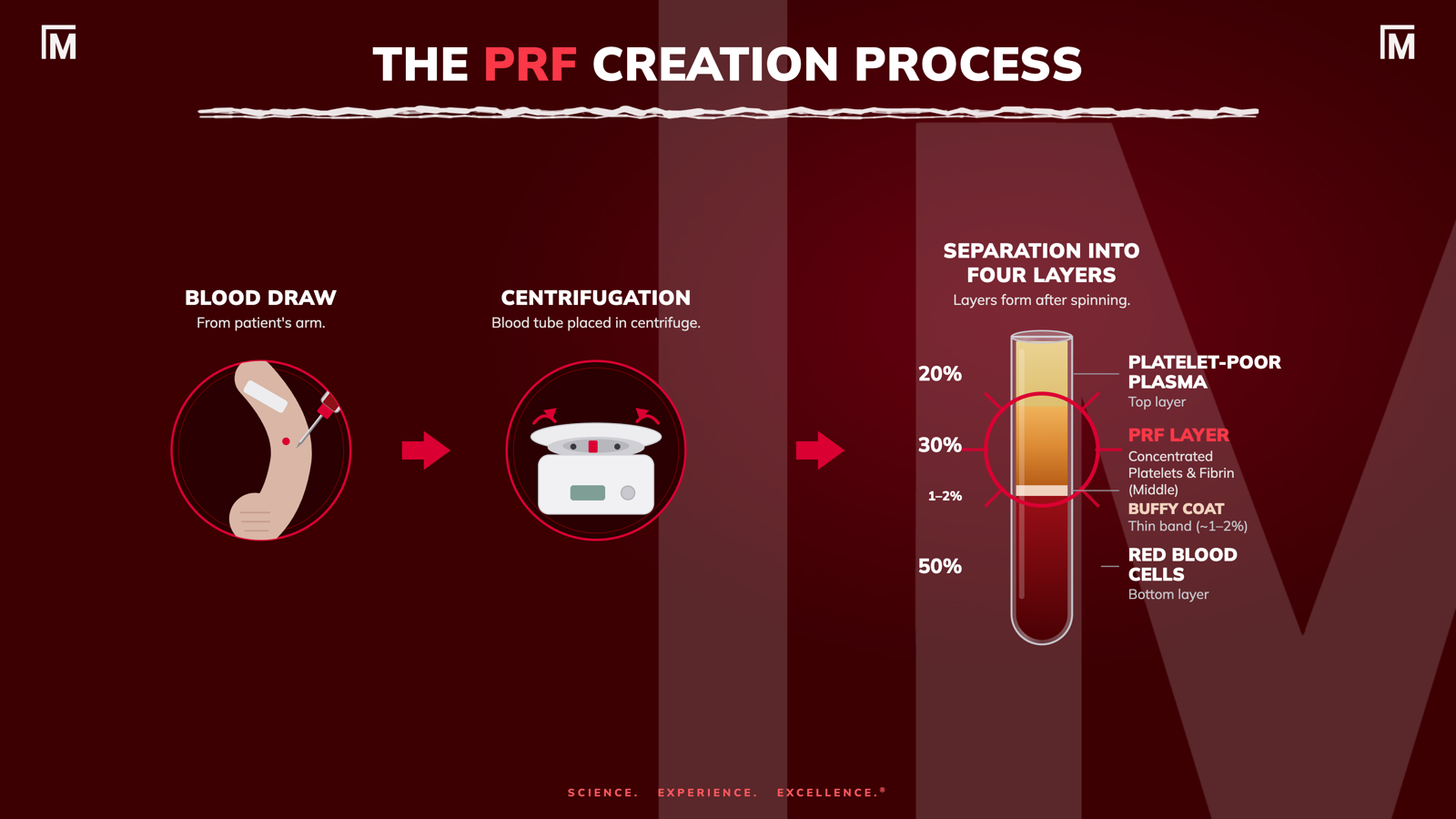 The PRF creation process — blood draw, centrifugation, and separation into four layers: platelet-poor plasma, PRF layer, buffy coat, and red blood cells