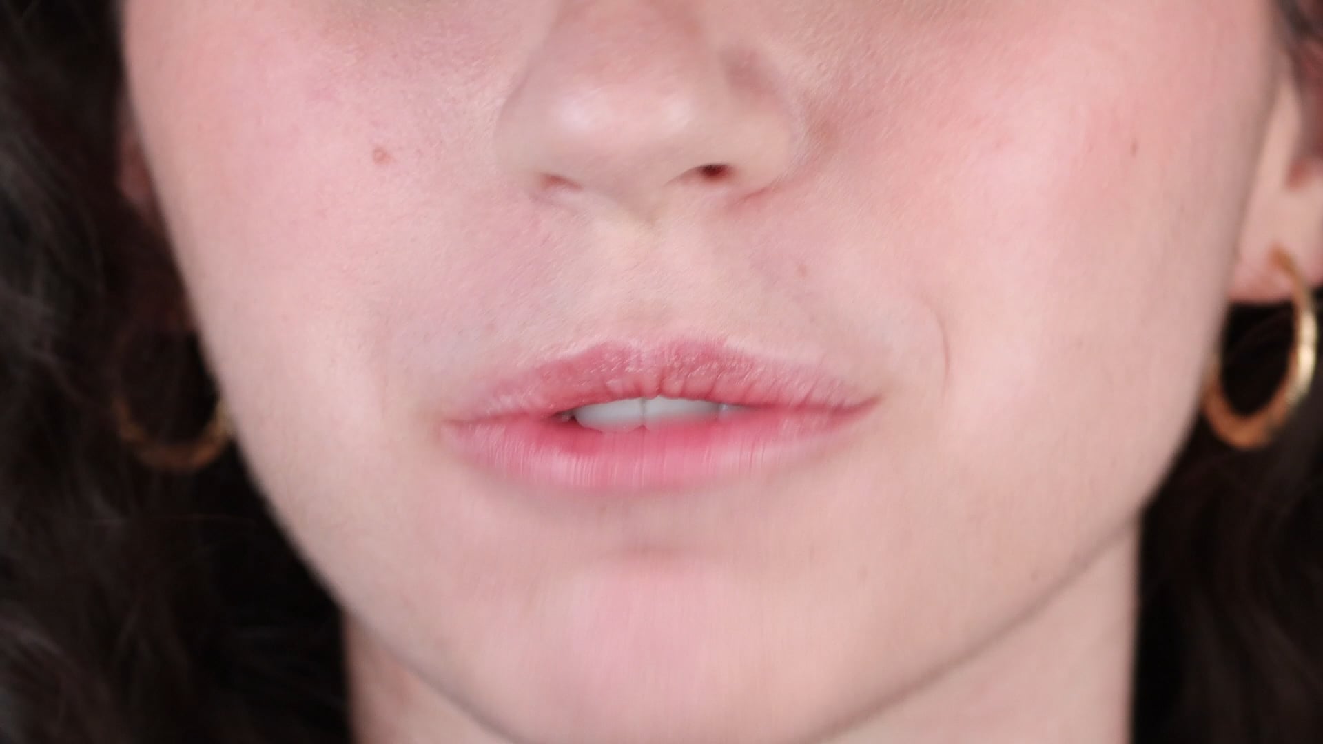 Esthetic Crown Lengthening